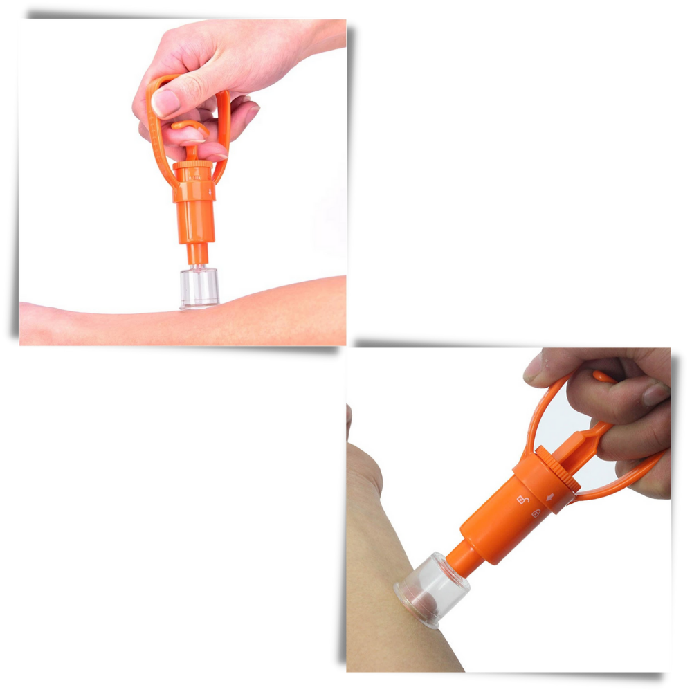 Notfall-Giftextraktionskit - Ozerty