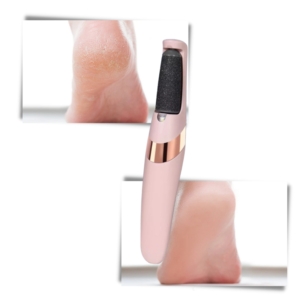 Elektrischer Hornhautentferner - Ozerty