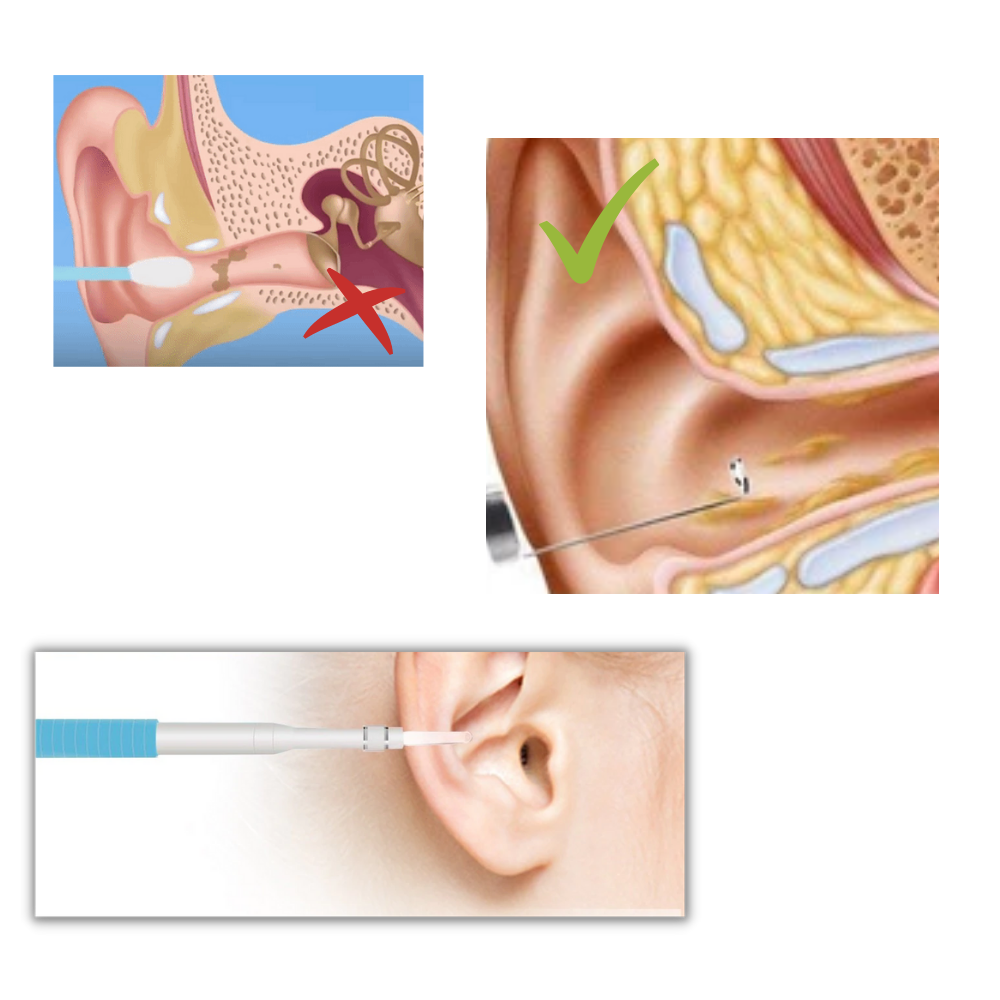 3 in 1 Ohrkamera - Ozerty