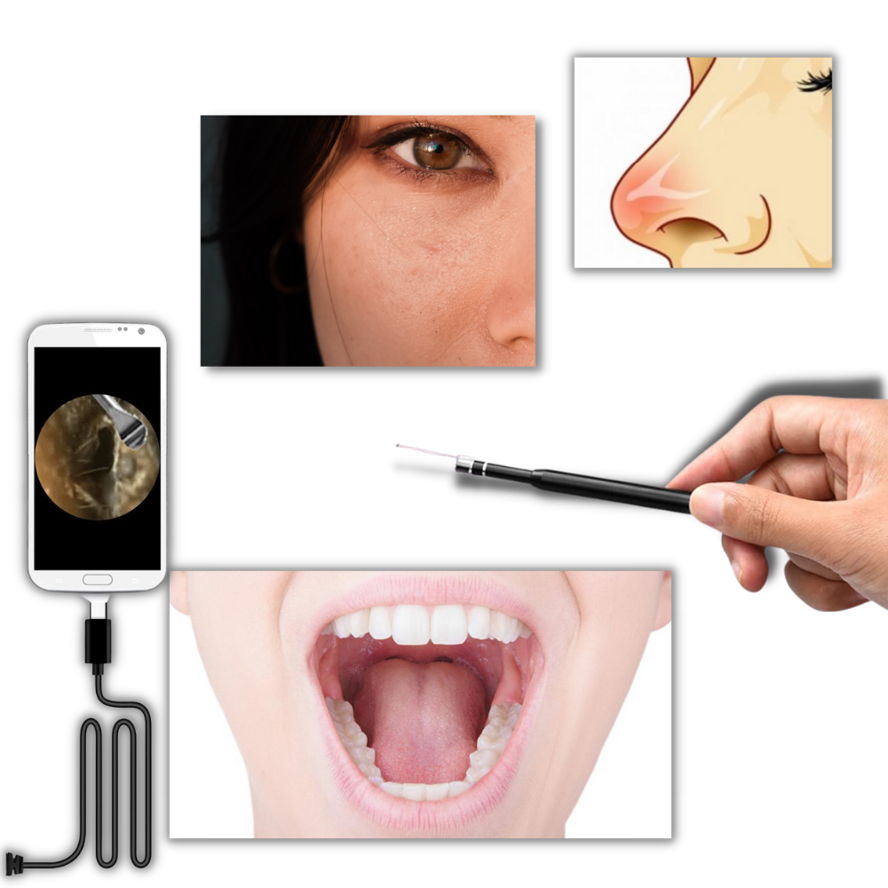 3 in 1 Ohrkamera - Ozerty