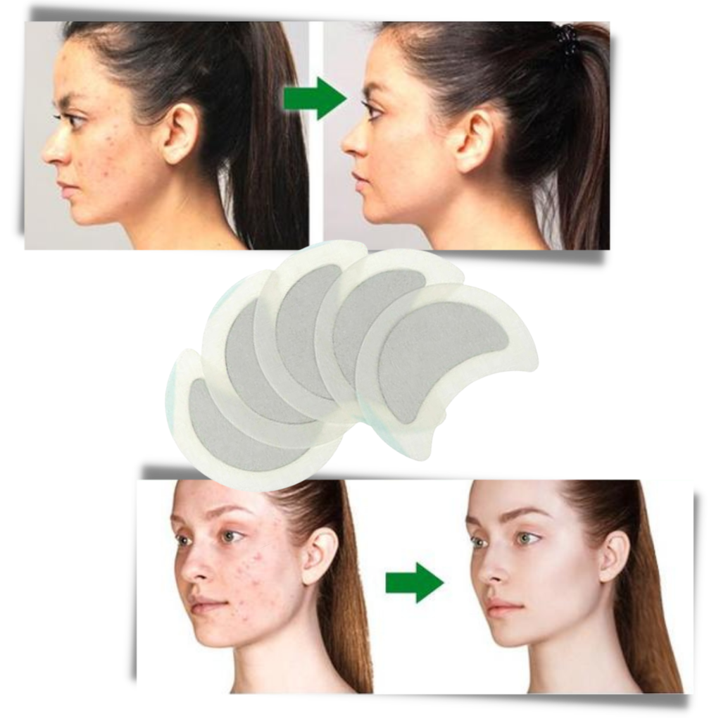 5 x Anti-Schweiß-Kräuter-Lymphpflaster - Ozerty