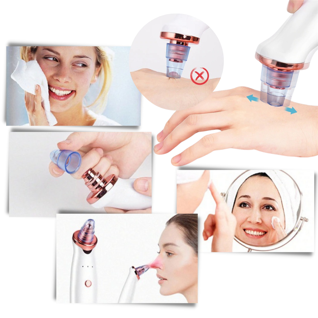 Mitesser Porenentferner Vakuum - Ozerty