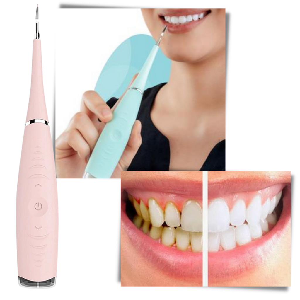 Tief reinigende Zahnsteinmaschine - Ozerty