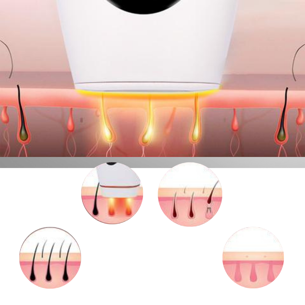 IPL Laser Haarentferner Handgerät  - Ozerty