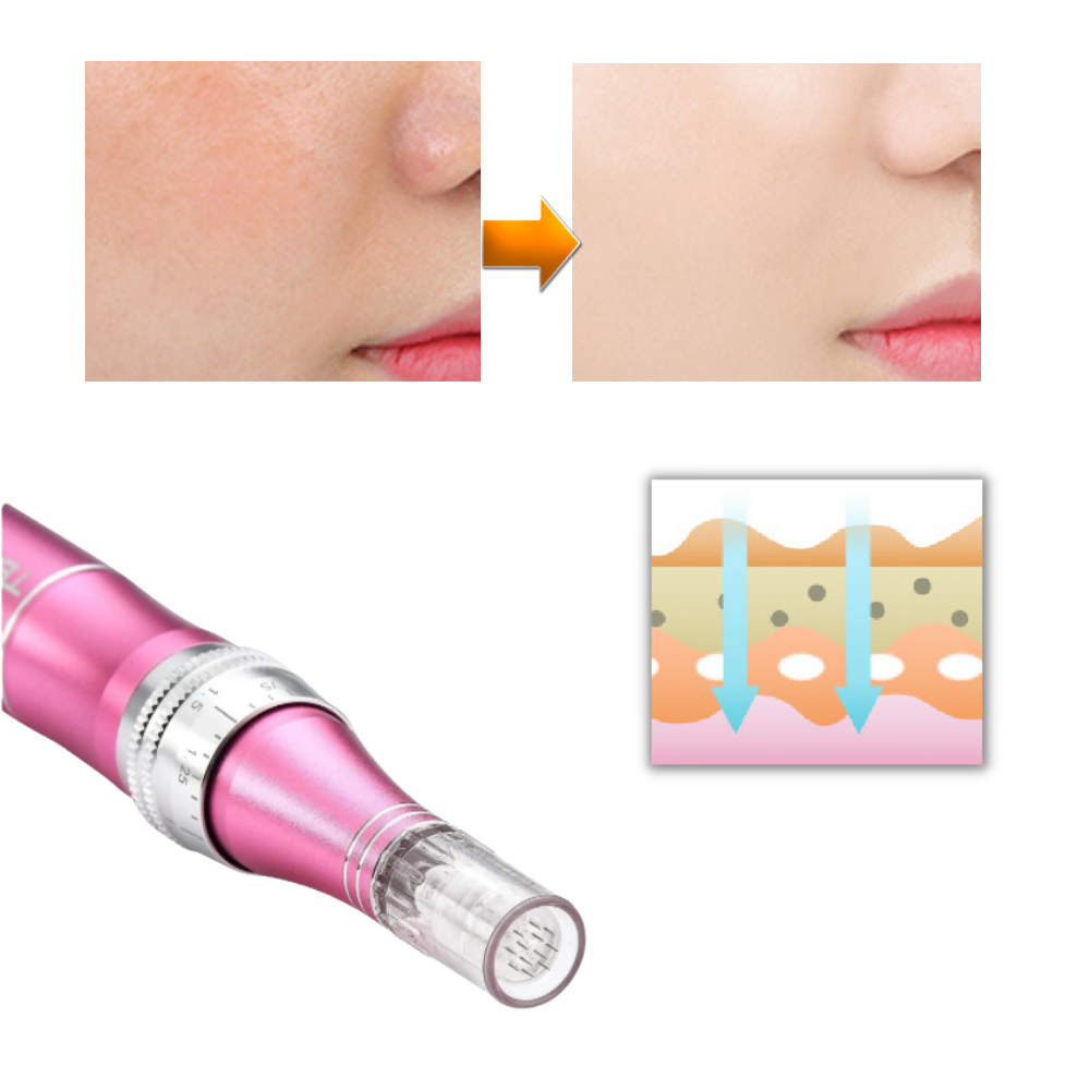 Dermal Microneedling Stift - Ozerty