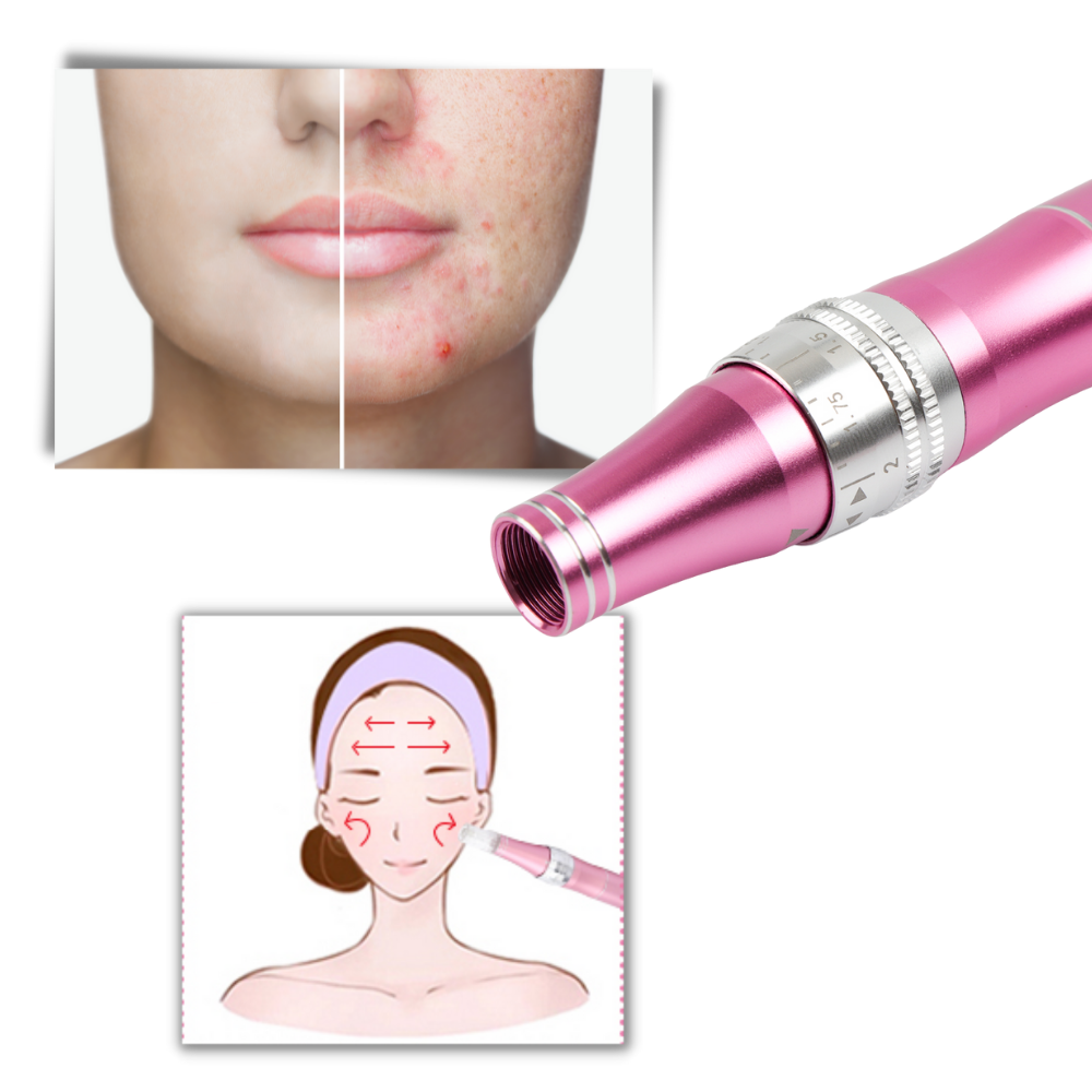 Dermal Microneedling Stift - Ozerty