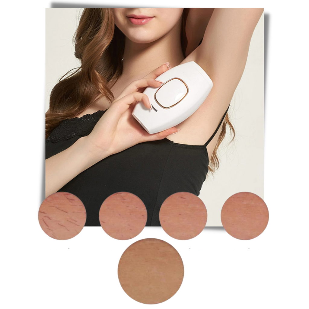 Mini IPL-Laser Haarentferner - Ozerty