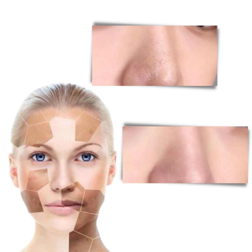 Porenlose Tiefenreinigung entfernen Mitesser grüner Tee Maske - Ozerty