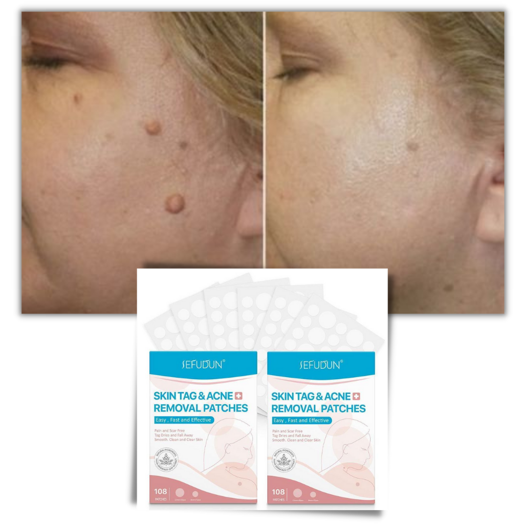 Haut-Tag Entfernung Behandlung Patch - Ozerty