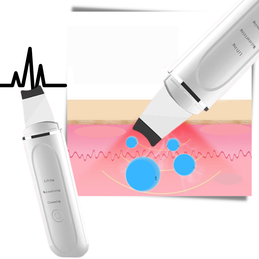 Ultraschall-Tiefenreinigungsgerät für das Gesicht - Ozerty