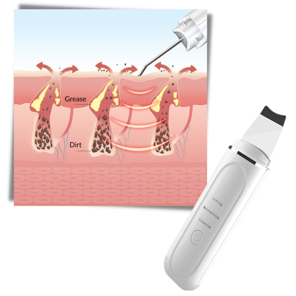 Ultraschall-Tiefenreinigungsgerät für das Gesicht - Ozerty
