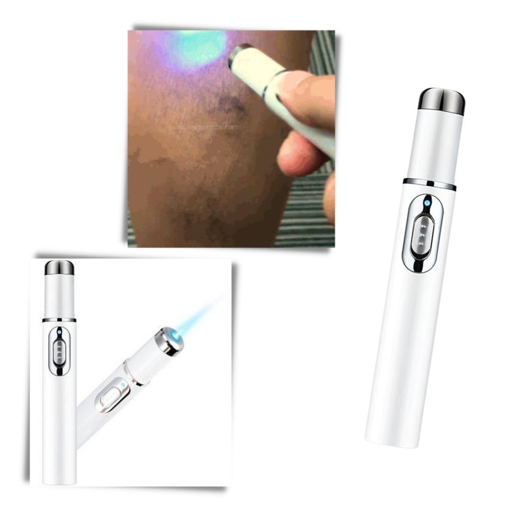 Blaulicht-Hauttherapie-Stift - Ozerty