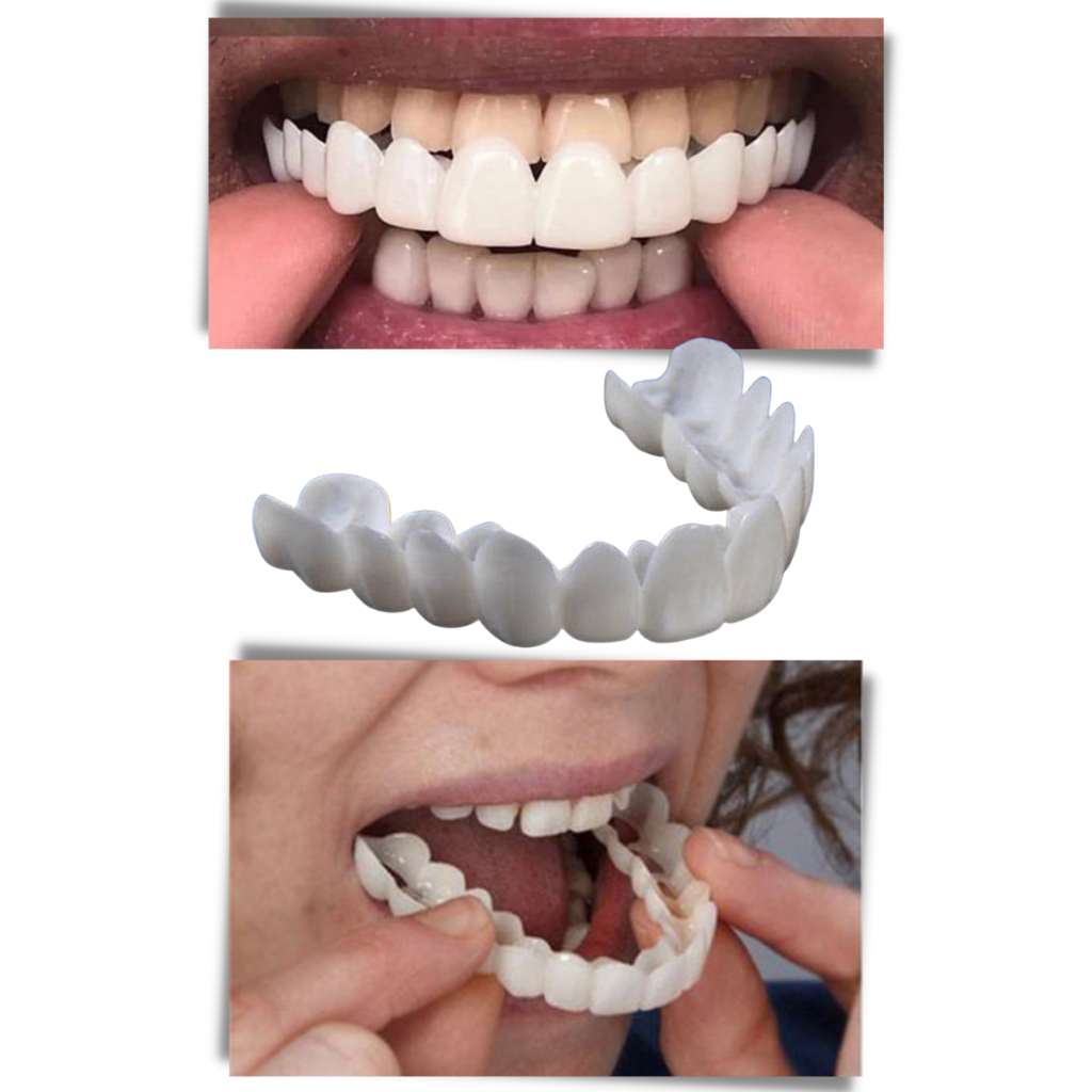 Perfektes Lächeln - komfortable Zahnabdeckung - Ozerty