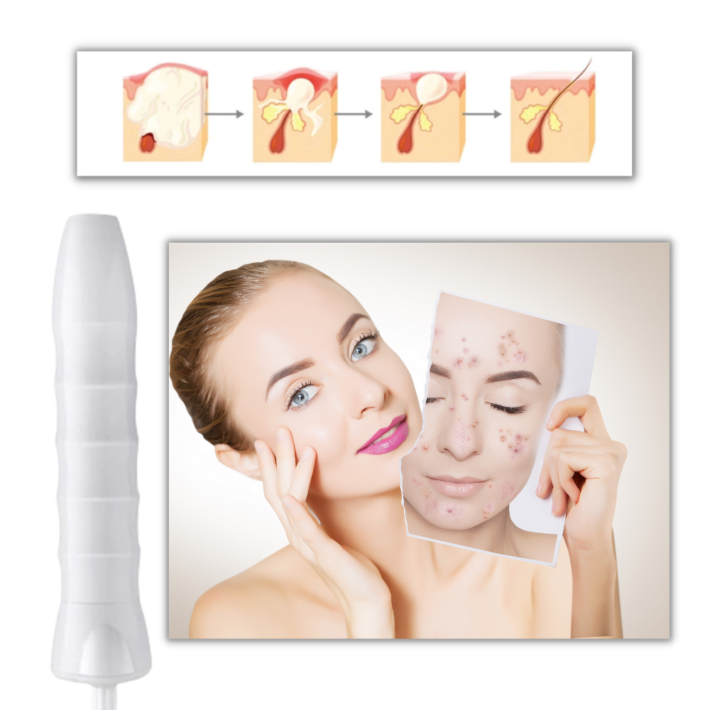 Anti-Aging-Haut Lichttherapie - Ozerty